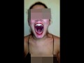 Girl Huge Mouth & Long Tongue