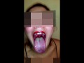 Girl Huge Mouth & Long Tongue