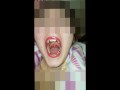 Girl Open wide Mouth