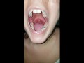 Girl Open Wide Mouth and Burping