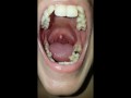 Girl Open Wide Mouth and Burping