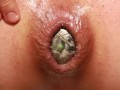 Extreme Naheinstellung vom Arschloch bei Analgeburt