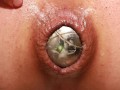 Extreme Naheinstellung vom Arschloch bei Analgeburt
