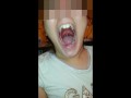 Girl Huge Mouth & Long Tongue pt2