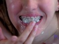 Cum on the Babysitter's Braces