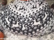 Sabrina Sabrok new booty augmentation