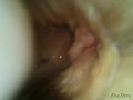 Filmed the vagina from the inside