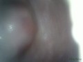 Filmed the vagina from the inside
