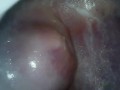 Filmed the vagina from the inside