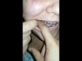 girl biting hard finger
