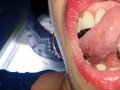 Mouth, tongue and teeth fetish I - Short