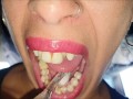 Mouth, tongue and teeth fetish II - Short