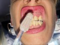Mouth, tongue and teeth fetish II - Short