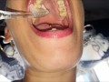Mouth, tongue and teeth fetish II - Short