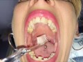 Mouth, tongue and teeth fetish II - Short