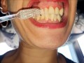 Mouth, tongue and teeth fetish II - Short
