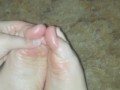 Bendy toes need oiled up