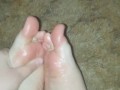 Bendy toes need oiled up