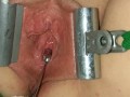 Female Urethral Sounding Orgasm Stretched &amp; Clamped Pussy S&amp;M Medical Play