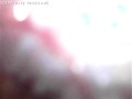 Spiel Maschinerie's endoscope throat explore
