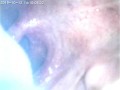 Spiel Maschinerie's endoscope throat explore