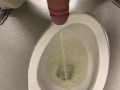 Short pee at doctor office 