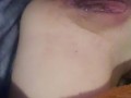 She need to cream