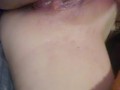 She need to cream