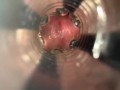 Internal view (with cumshot)