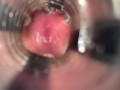 Internal view (with cumshot)