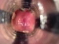 Internal view (with cumshot)