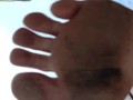 Dirty soles from stepping on lit cigarettes all day