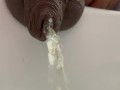 Pissingwithforeskin