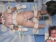 Sweet Peaches asylum patient electroshock multiple orgasm therapy