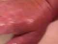 Anal Gape