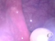 CAM INSIDE ASS: The Balls disappeared deep inside my hole ⚽⛓ - Preview