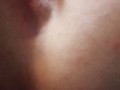 Mini gape