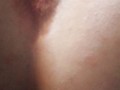 Mini gape