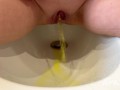 big open vagina pissing yellow urine in a bidet