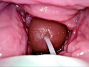Cum Inside Me Over and Over! Camera inside Vagina Creampie Cervix POV