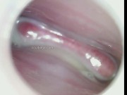 Super Creamy Dripping Gooey Mucus Cervix Thrusting Feels So Good