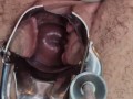 Hairy Pussy Gaping, Fucking & Orgasming While My Pussy Is Stretched Open With A Speculum