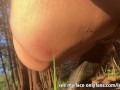 Watch My Anus While I Pee in the Woods