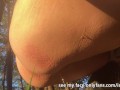 Watch My Anus While I Pee in the Woods