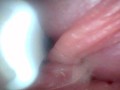 Endoscope camera shows the most sensitive parts of the penis Educational video