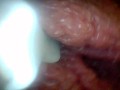 Endoscope camera shows the most sensitive parts of the penis Educational video