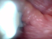 Endoscope camera shows the most sensitive parts of the penis Educational video