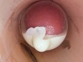 The camera in the deep pussy records a huge ejaculation of sperm into the condom