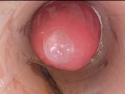 The camera in the deep pussy records a huge ejaculation of sperm into the condom