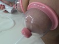 Vacuum pump for breast massage. Experiment